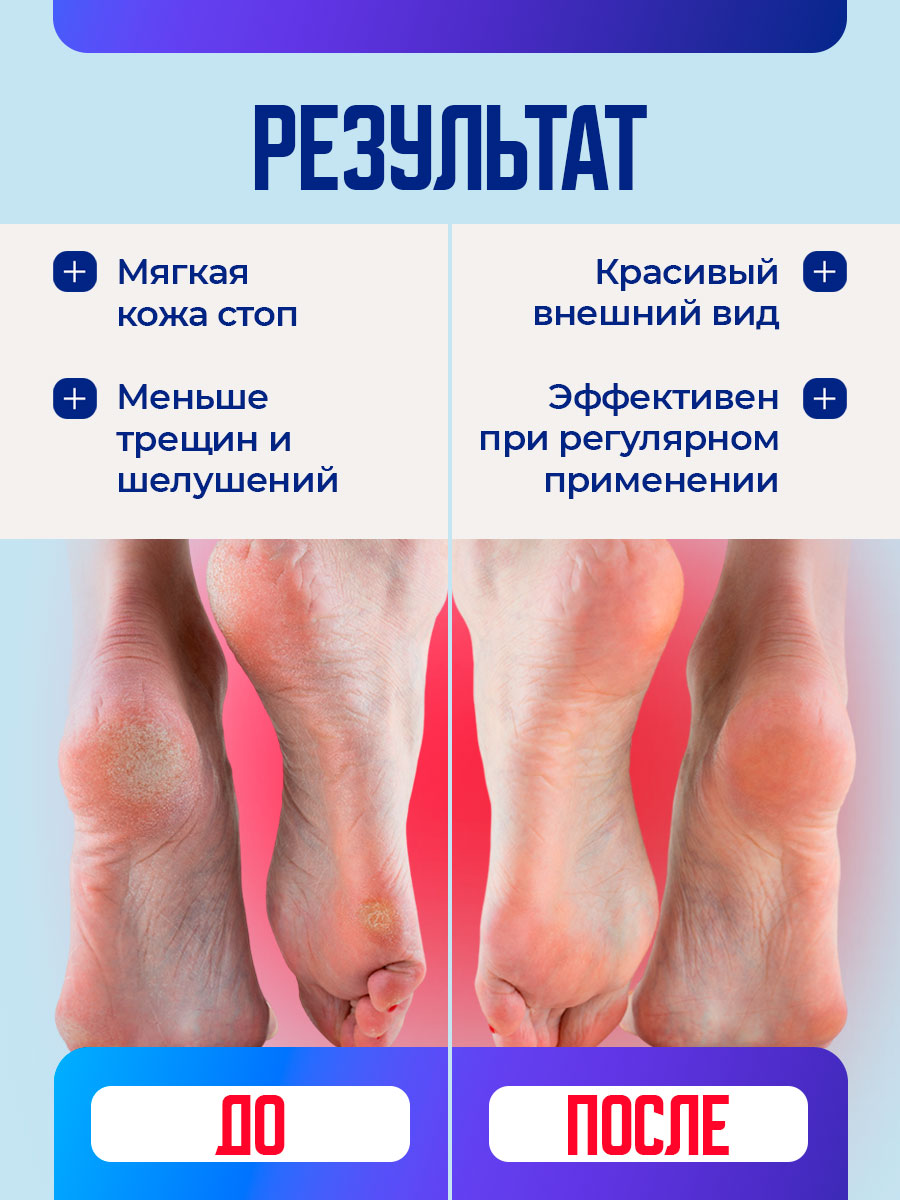 Foot Therapy Крем-уход за потрескавшейся, сухой кожи пяток 150мл от Novosvit + 6